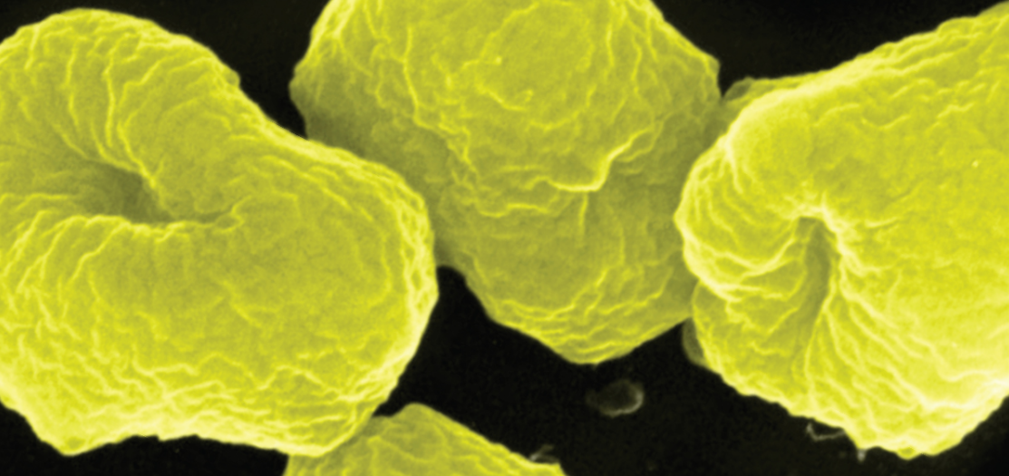 Similarities Between Archaeans and Aacteria