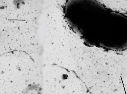 Sulfate reducing bacteria